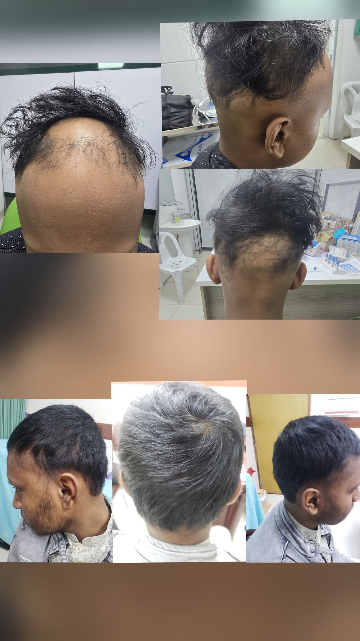 Hair