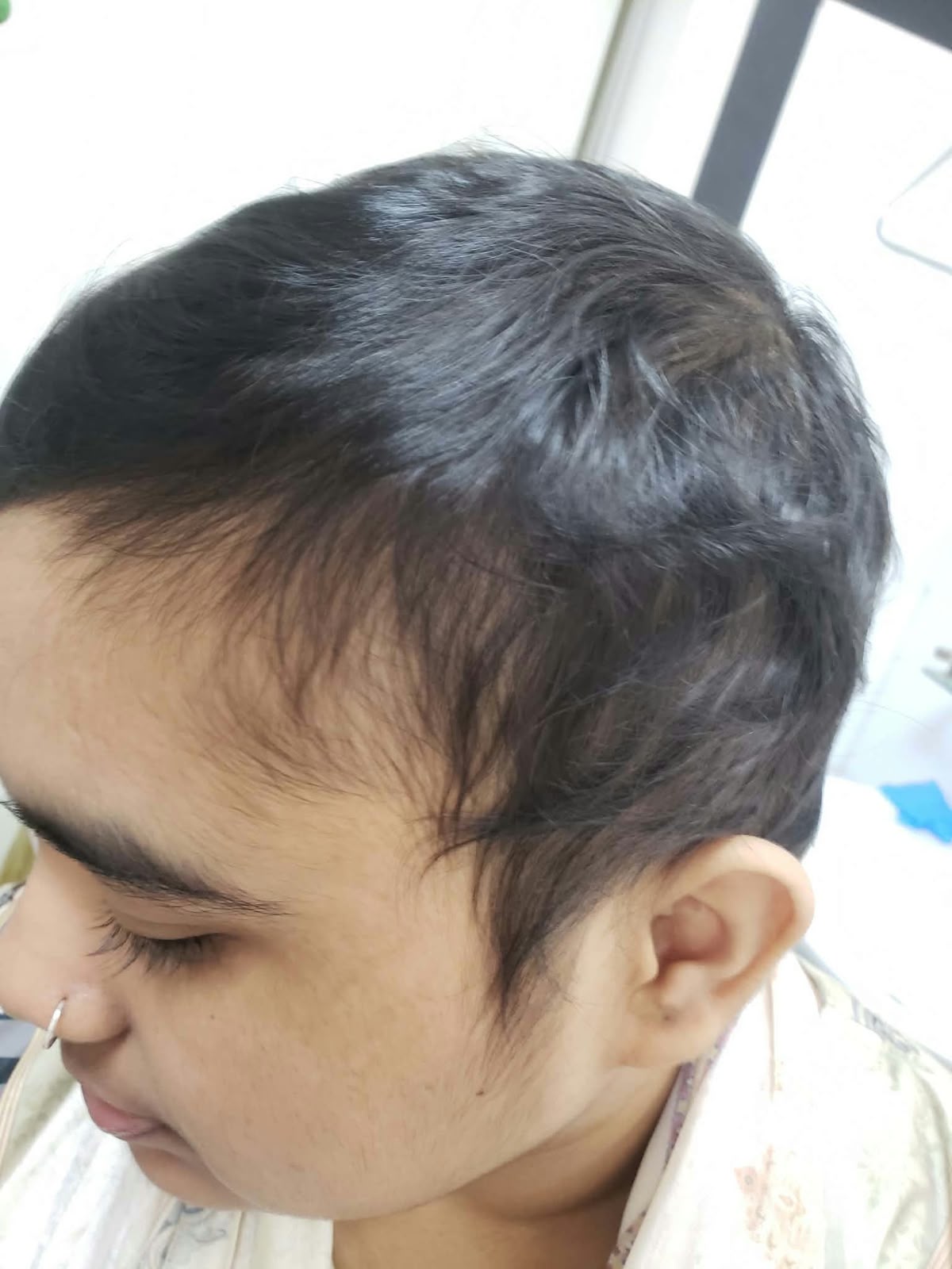 Hair Treatment