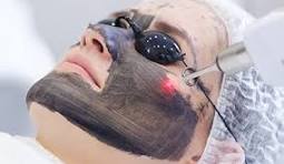Laser