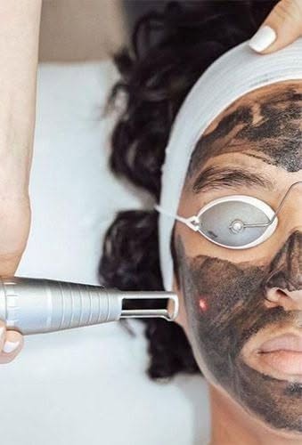 Laser Treatment
