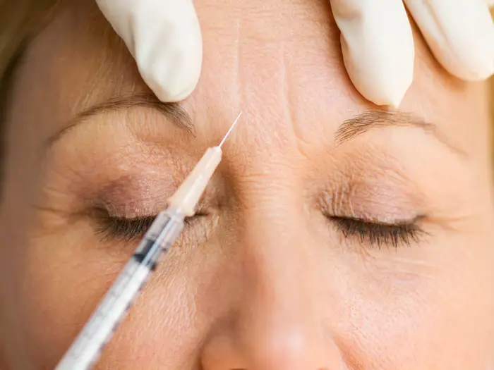 Botox